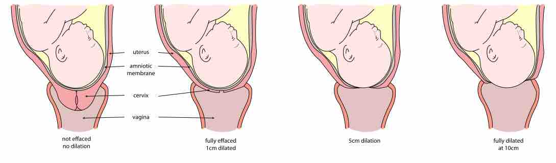 cervix opening during labor