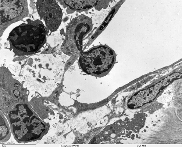 File:Blood cell crossing vascular sinus wall - TEM.jpg