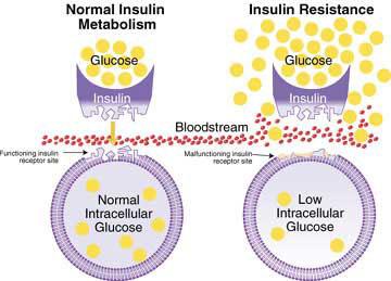 File:Insulinresistance.jpg