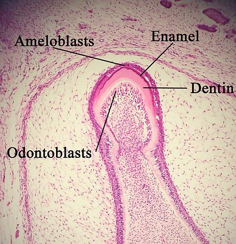 File:Enamelmineralization11-17-05.jpg
