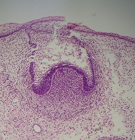File:Capstage11-23-05.jpg