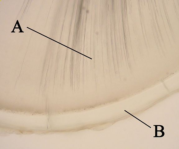 File:Crosssectionroottooth11-24-05.jpg