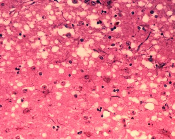 File:Histology bse.jpg