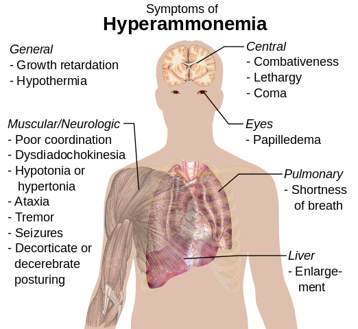 File:Symptoms of hyperammonemia.svg