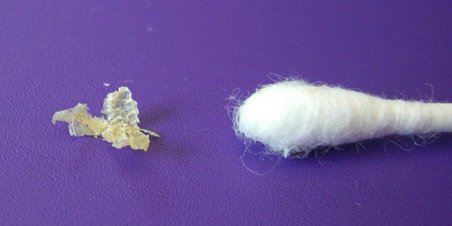 File:Dry earwax.jpg