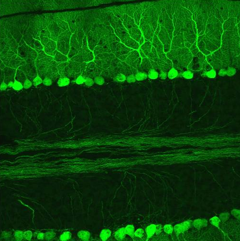 File:L7cerebellum.png