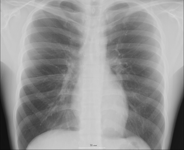 File:Chest.png